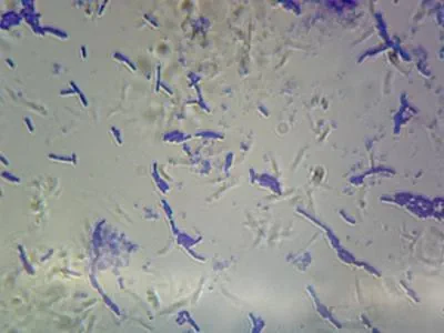 Сенная палочка bacillus subtilis под микроскопом